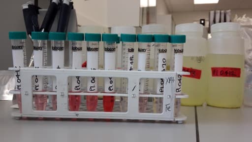Filtering samples through the Sterivex column.